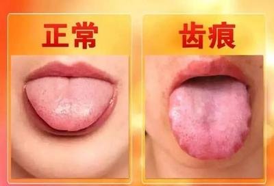肠胃病，系列脾胃问题【医案总述】
